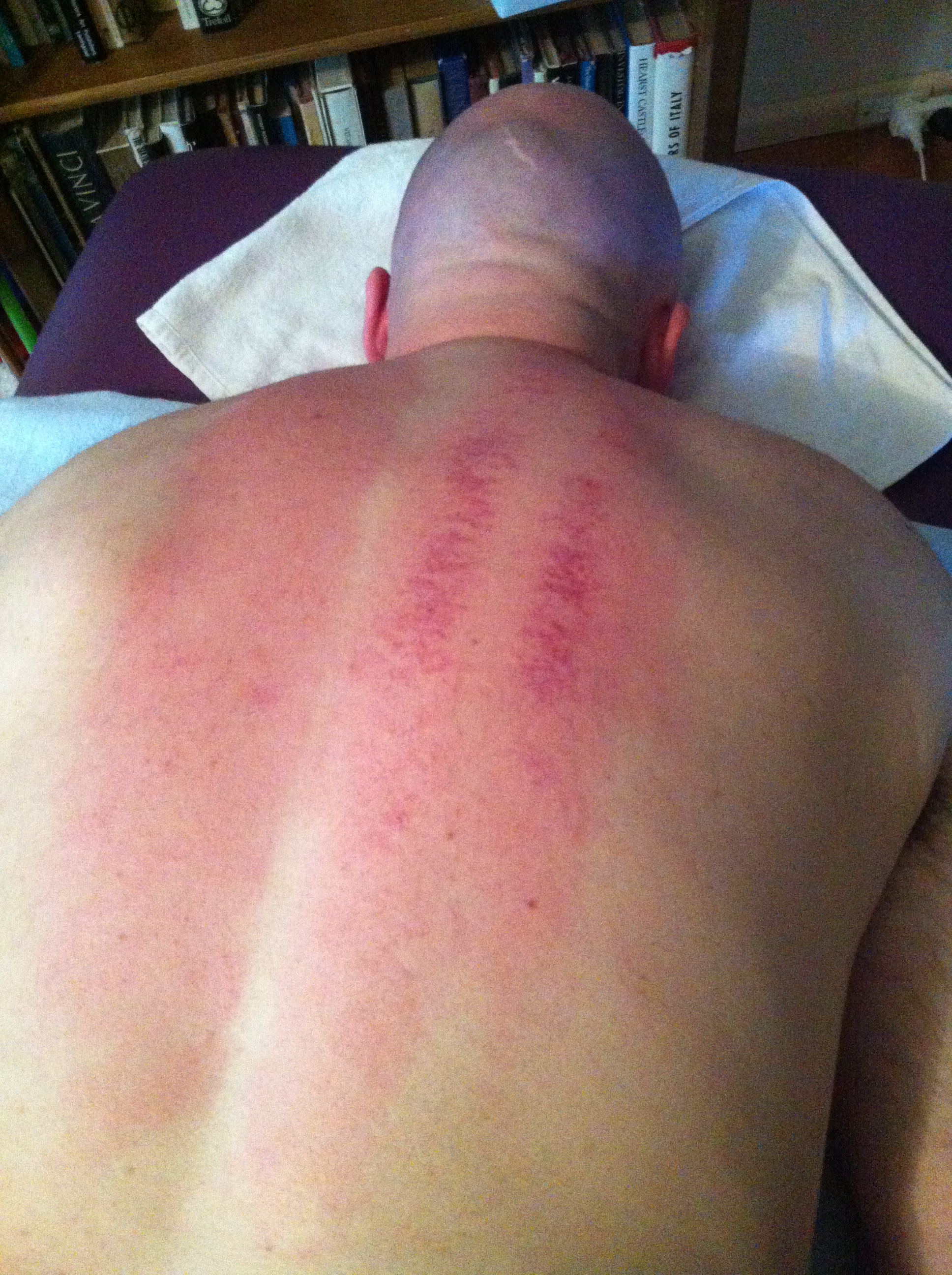 GUA SHA